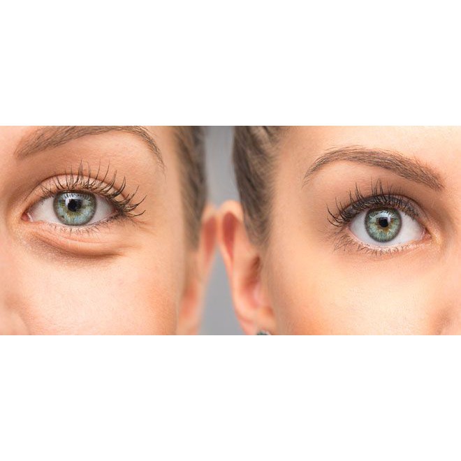 BALANCE - Kem mắt chống lão hóa nọc rắn Balance Active Formula Snake Venom Eye Cream 15ml | BigBuy360 - bigbuy360.vn