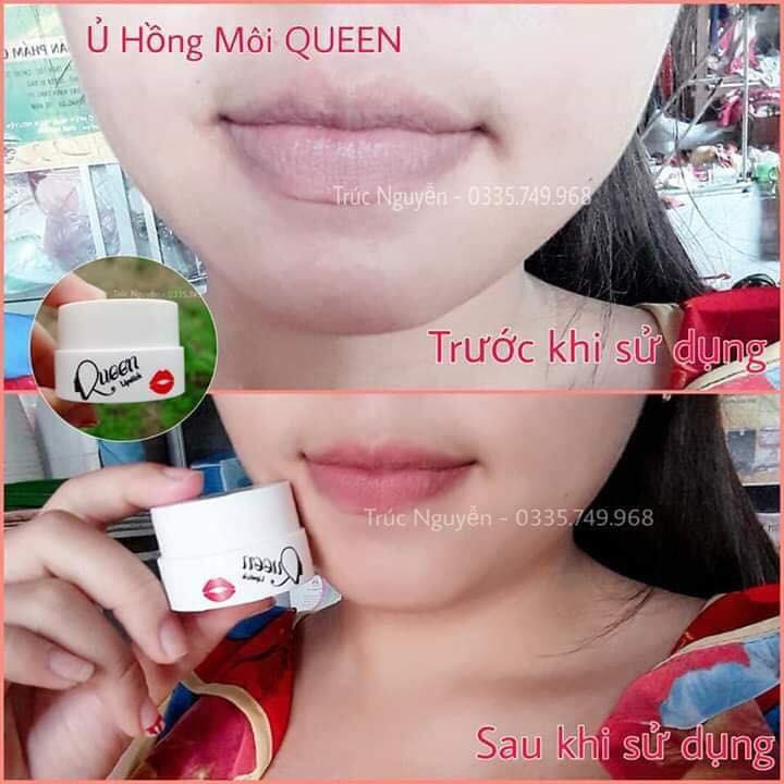 Ủ Hồng Môi, Hồng Ti Queen [TẶNG KÈM BĂNG ĐÔ TAI MÈO]. | BigBuy360 - bigbuy360.vn