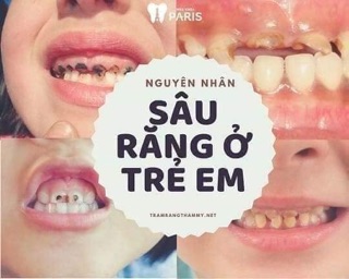 Thuốc răng miệng