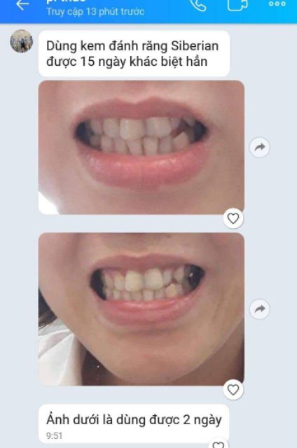 Kem đánh răng thảo mộc Siberi của Nga, không flour, sunflate, paraben, chất tạo màu tạo mùi,chất tẩy trắng và tạo bóng.