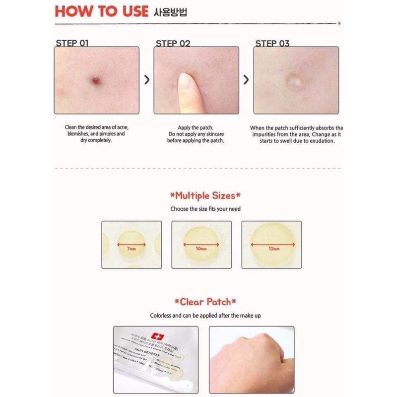 Miếng Dán Mụn Cosrx Acne Pimple / Clear Fit Master Patch