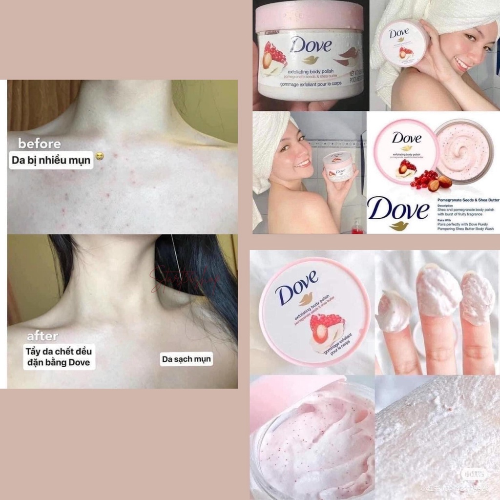 Tẩy tế bào chết body Start36 tẩy da chết Dove da body trắng sáng, mịn màng, giảm mụn, bản Đức 225ml
