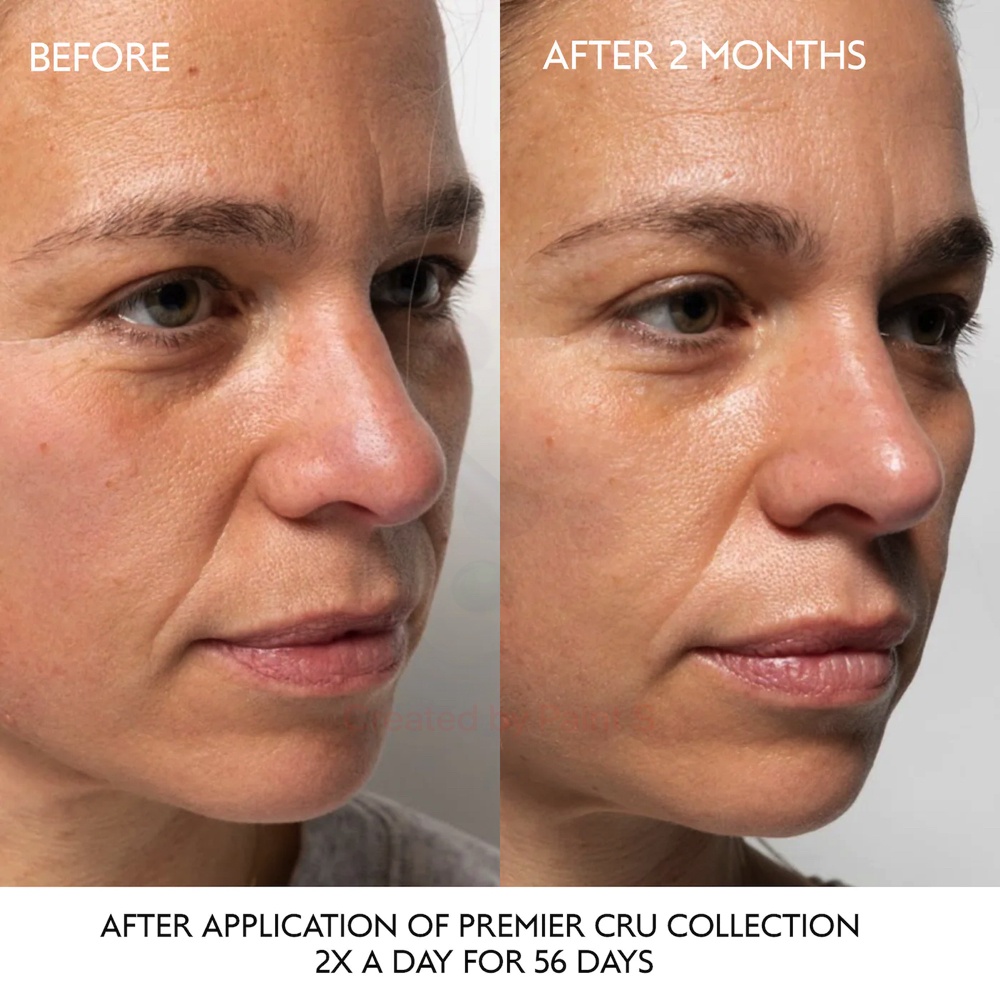 CAUDALIE 🌿 Tinh chất chống lão hoá Premier Cru Anti-Aging Serum