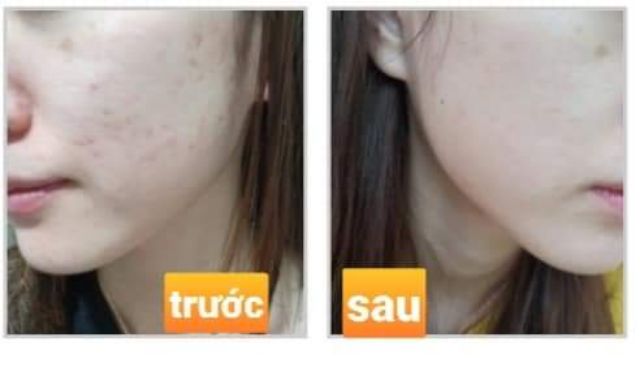 Serum tinh chất Phục hôi_cấp nước _ làm trắng Celimax The Real Noni