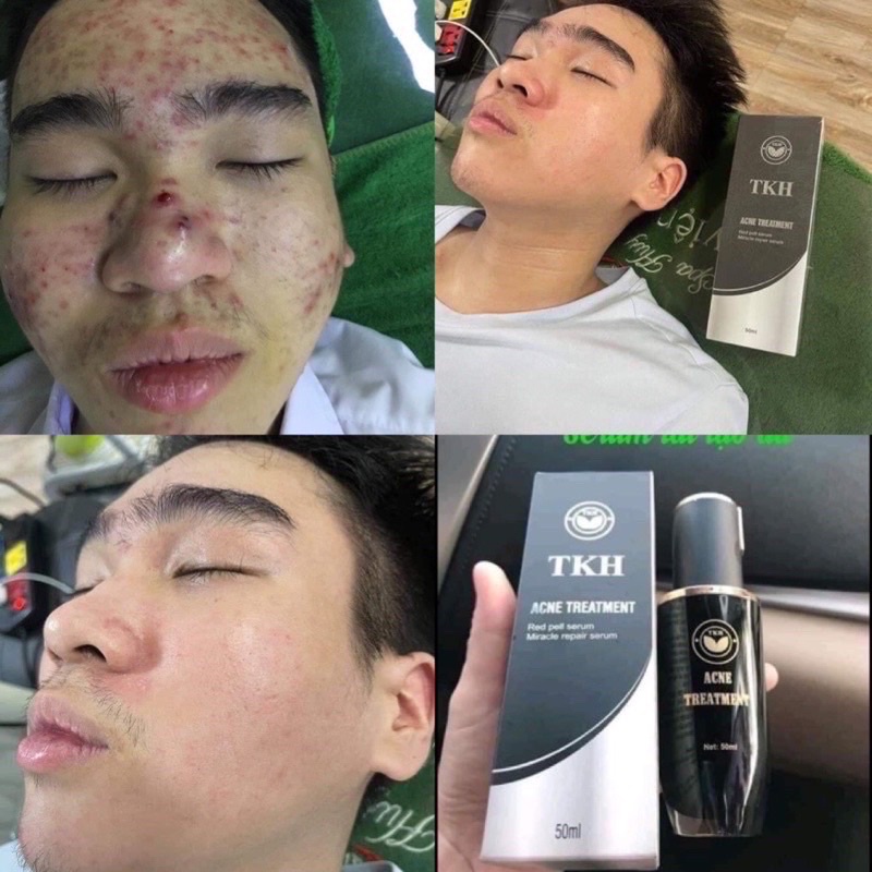 SERUM TÁI TẠO DA NHÂN SÂM TRẦN KIM HUYỀN