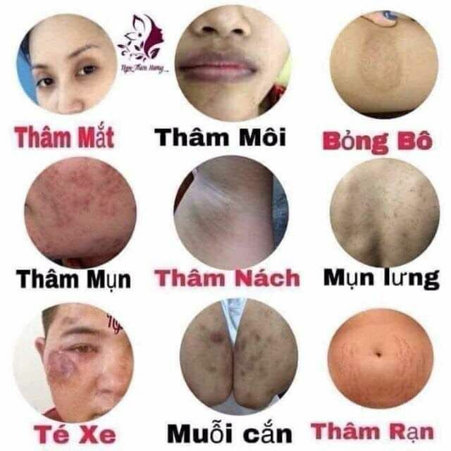 Ol cell hút thâm nách, thâm moi