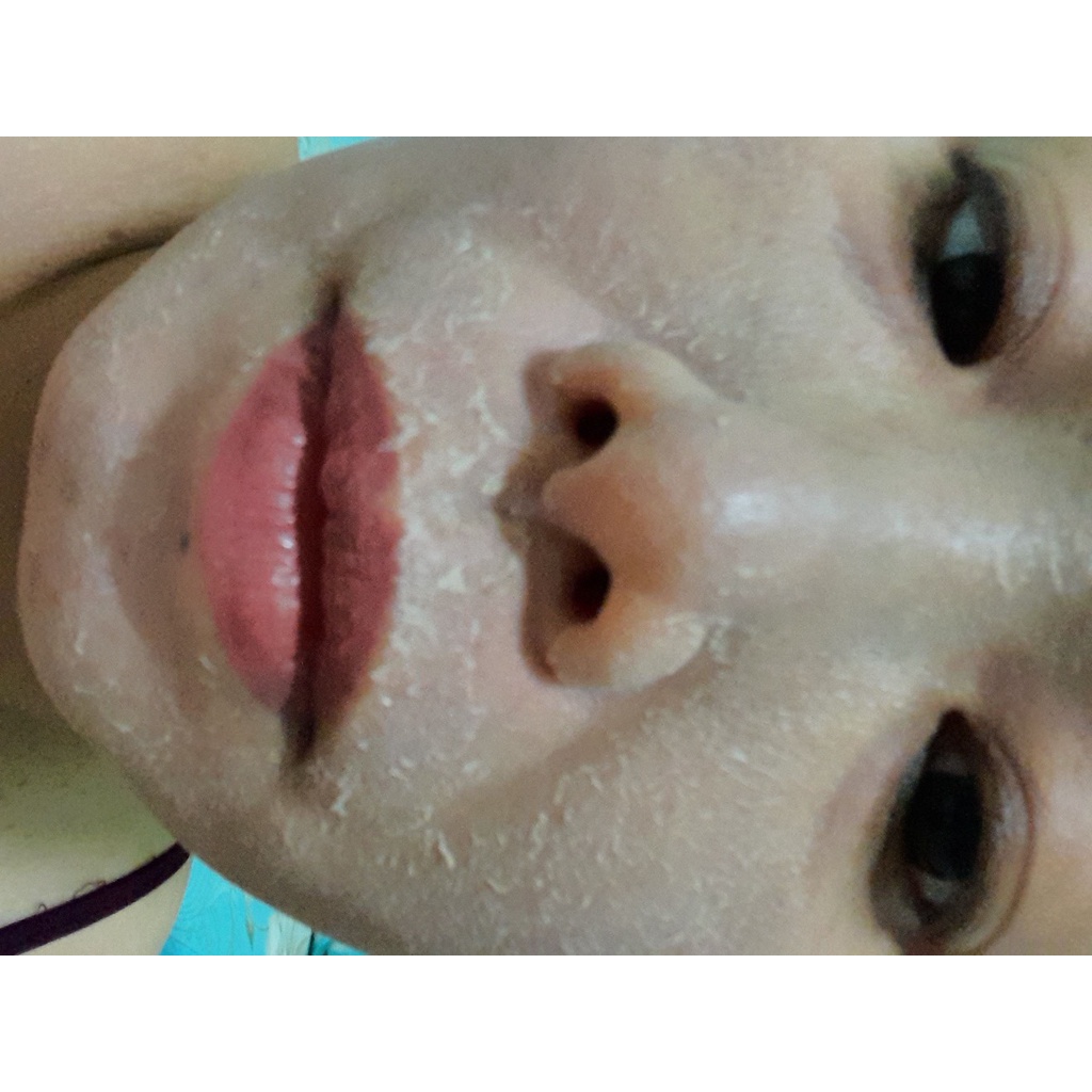 Kem Tái Tạo 1.1 Da Đông Y Tái Tạo Da Mặt Hiệu Quả Xóa Tan Mụn Nám Tàn Nhang siêu bong nhanh mạnh hủ 25GR