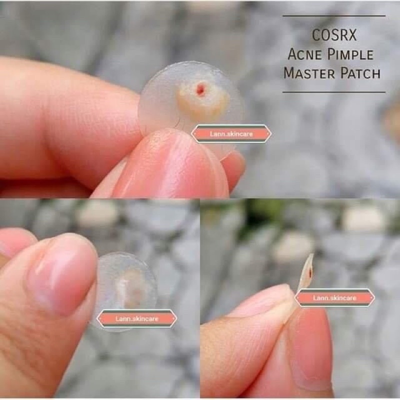 MIẾNG DÁN MỤN COSRX ACNE PIMPLE MASTER PATCH