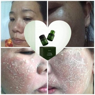 SERUM THAY DA NHÂN SÂM