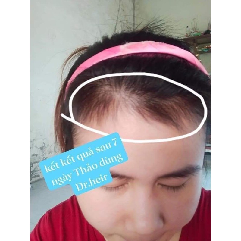 Zenpali Tinh chất dài mi mọc tóc Dr Hair - Zenpali