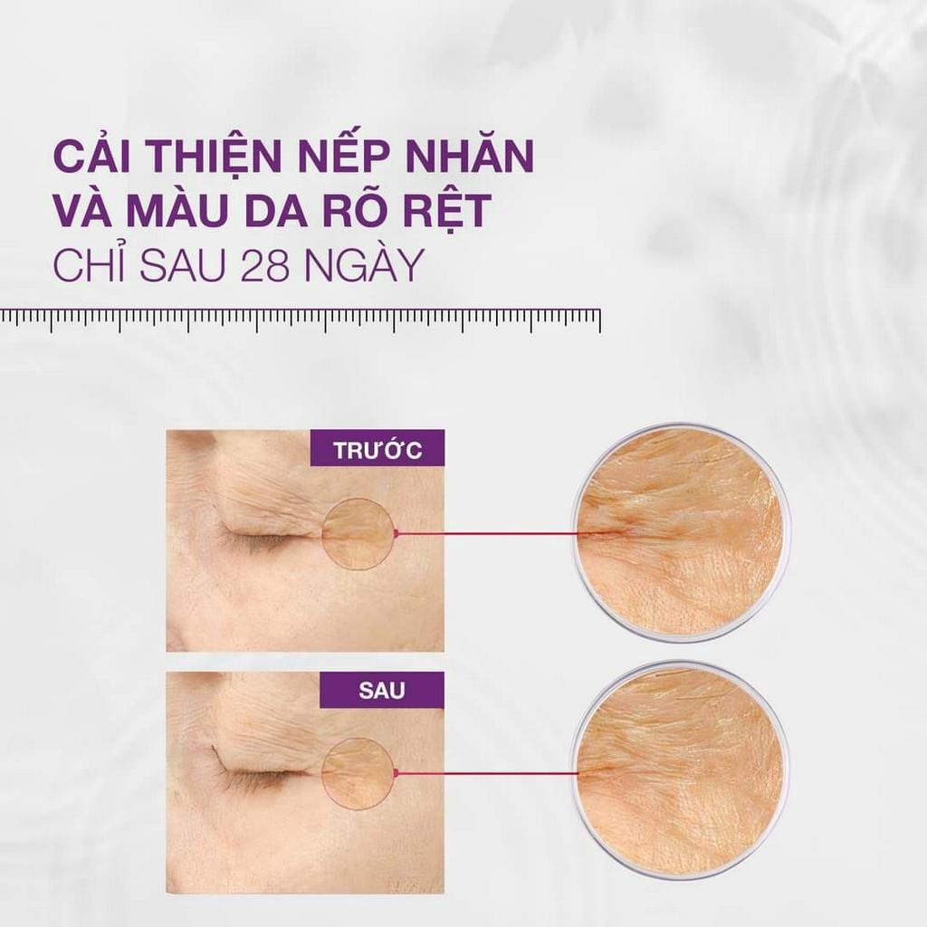 SkinClinic Retiplus 1% Kem Dưỡng Retinol + Vitamin C Ngăn Ngừa Lão Hóa Da Ban Đêm