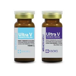 Vi kim tảo ultral V