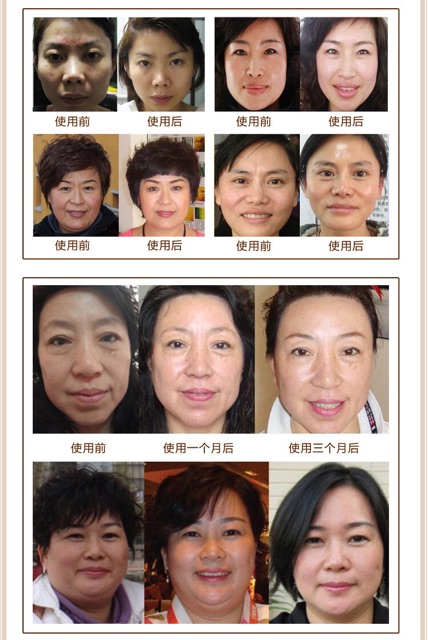 Hộp 5 Lọ tế bào gốc Baishict | BigBuy360 - bigbuy360.vn