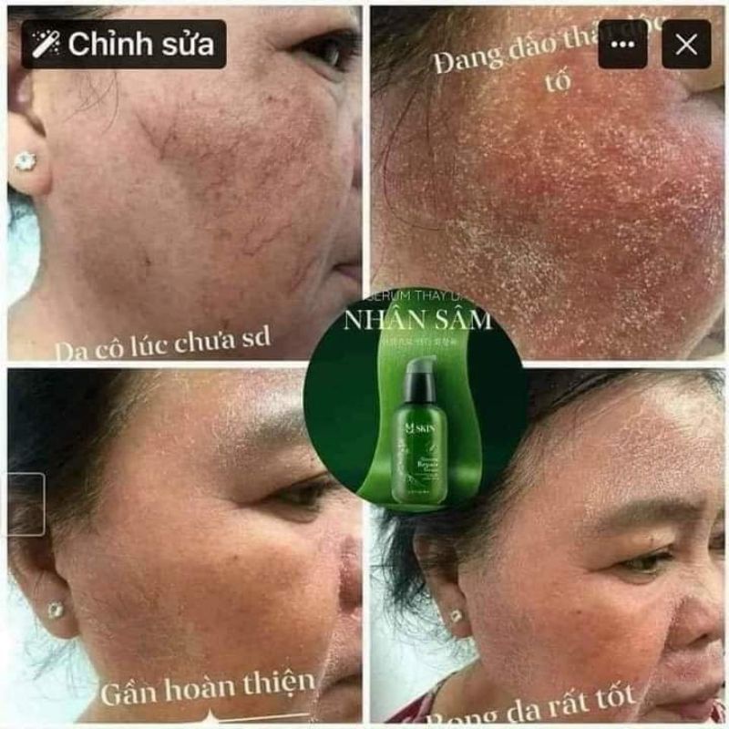 SERUM THAY DA NHÂN SÂM