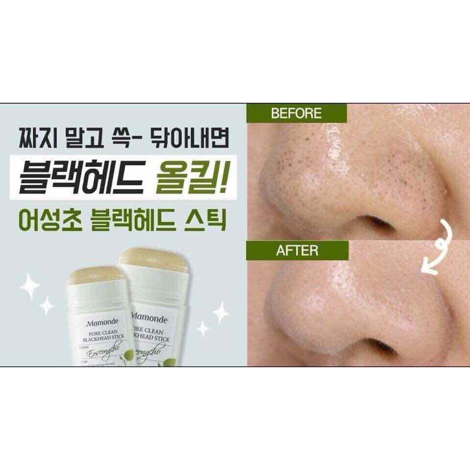 THANH LĂN MỤN ĐẦU ĐEN MAMONDE