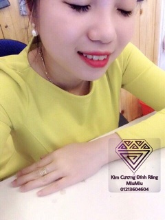 Đá mỹ đính răng loại 1