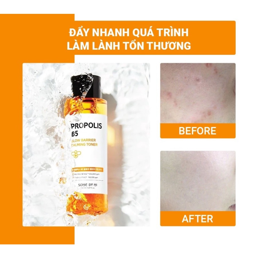 Nước Hoa Hồng Keo Ong &amp; Vitamin B5 Some By Mi Propolis B5 Glow Barrier Calming Toner 150ml quatangme