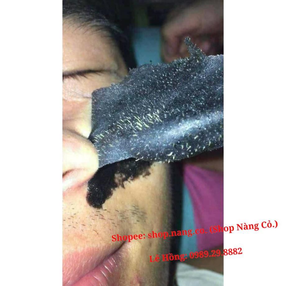 GEL HÚT MỤN Than Tre Hoạt Tính (100% Chính Hãng Ngân Bình) Gel lột mụn Than Tre, Lột mụn cám, mụn đầu đen, da chết Tốt | BigBuy360 - bigbuy360.vn