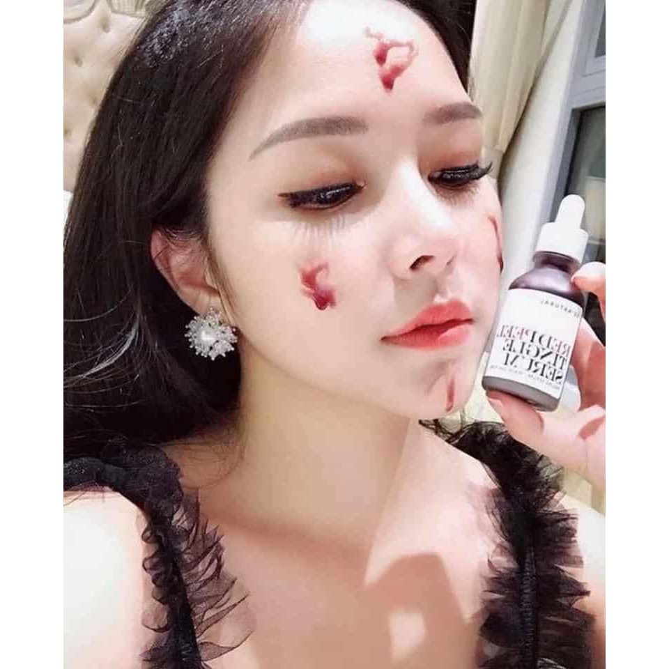 RED PEEL TINGLE SERUM -TINH CHẤT TÁI TẠO DA ĐÌNH ĐÁM