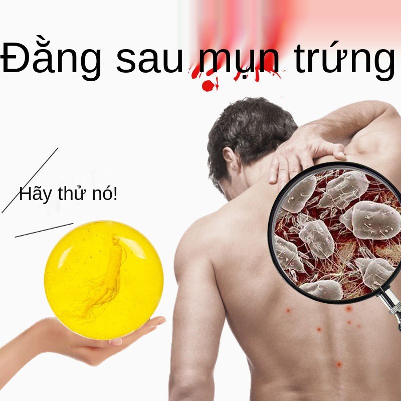 [Trừ Mite Sophora Soap] Nhân sâm chính hãng được giới thiệu và hướng dẫn sử dụng Xà phòng loại bỏ mạt đánh bay mụn cám,