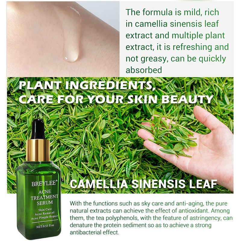 Serum hỗ trợ giảm Mụn BREYLEE Phục Hồi Làm Trắng Da 17ml | BigBuy360 - bigbuy360.vn