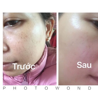 Kem collagen plus vit e
