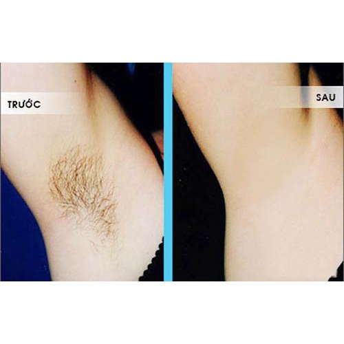 Wax lông + Mỡ trăn Triệt Lông Cany - Wax lông nách/ Tẩy lông tay chân/ Triệt lông vùng kín an toàn hiệu quả - CWL | BigBuy360 - bigbuy360.vn