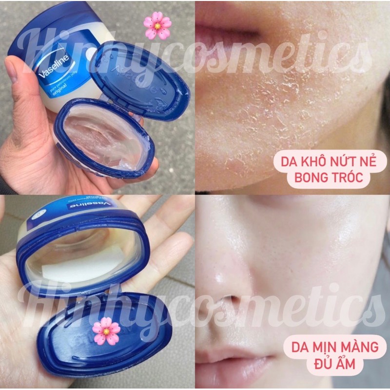 Kem Đa Năng Vaseline 49g | BigBuy360 - bigbuy360.vn