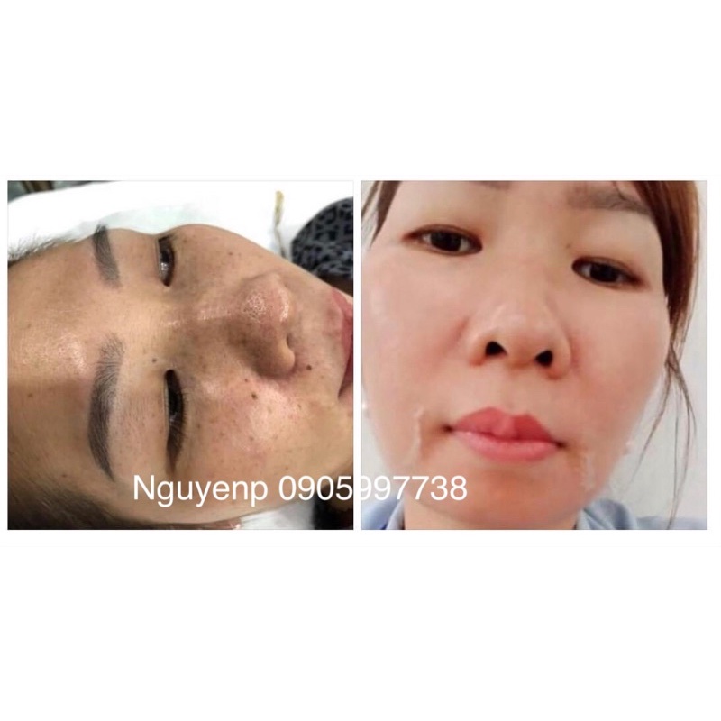 Kem dưỡng da tái tạo đông y MH ⚡ MẪU MỚI ⚡ kem dưỡng tái tảo da nhẹ nhàng đào thải các tế bào chết hiệu quả