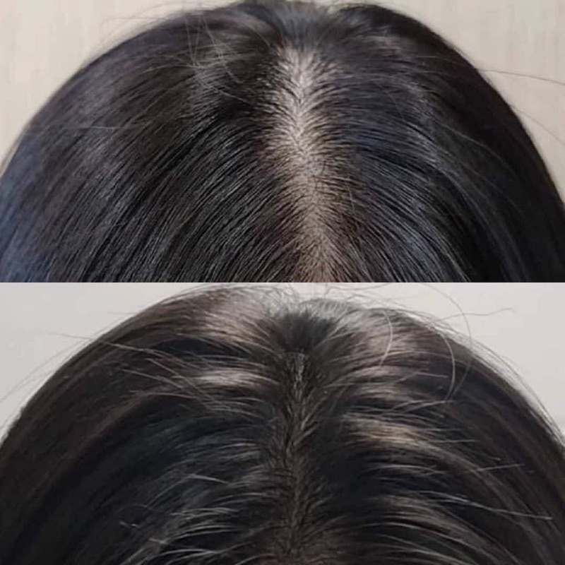 Cặp gội xả mọc & chống rụng tóc Megumi Nhật Bản