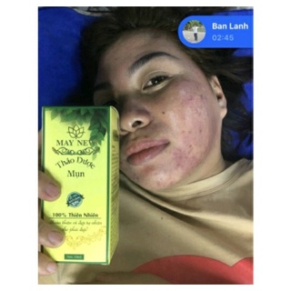 SERUM THẢO DƯỢC NHÂN SÂM SẠCH MỤN MAY NEW 50ML