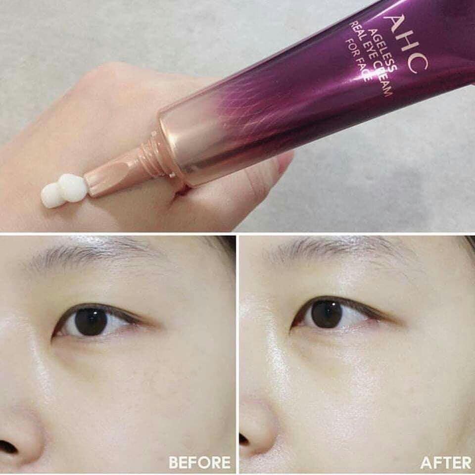 Kem Mắt AHC Angeless Real Eye Cream For Face 30ml [ Mẫu Mới Vỏ Xanh ]