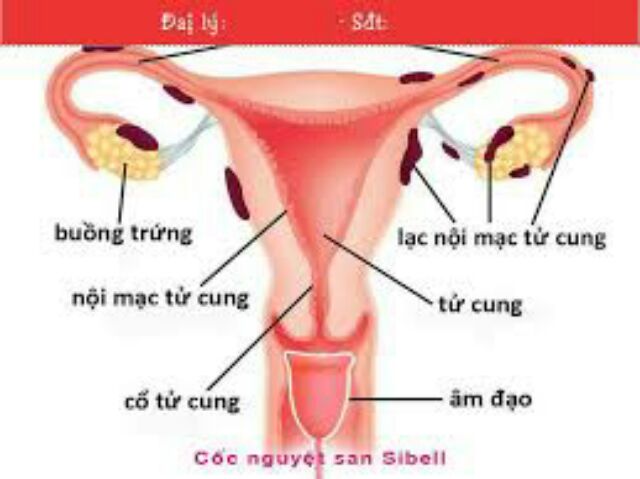 Cốc nguyệt san Sibell chính hãng nhập khẩu Pháp