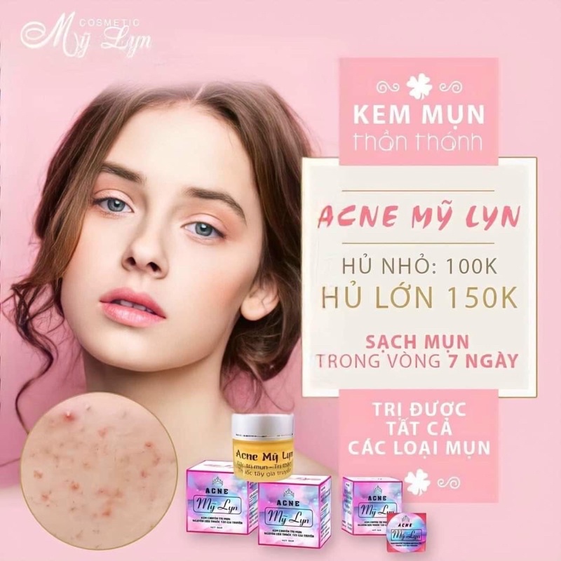 Acne Mỹ Lyn