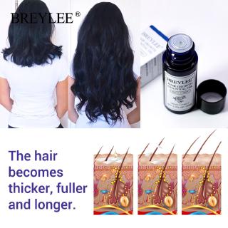 BREYLEE  2 Set Tinh dầu mọc tóc Chai Tinh Dầu Kích Mọc tóc