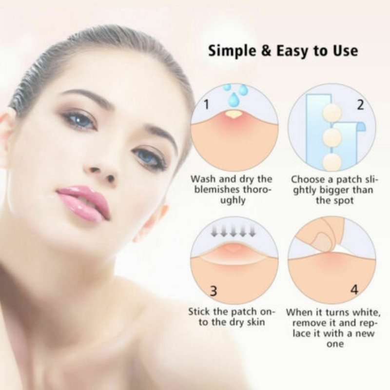 Bộ 36 Miếng Dán Loại Bỏ Mụn Đầu Đen / Mụn Trứng Cá Vô Hình Hiệu Quả