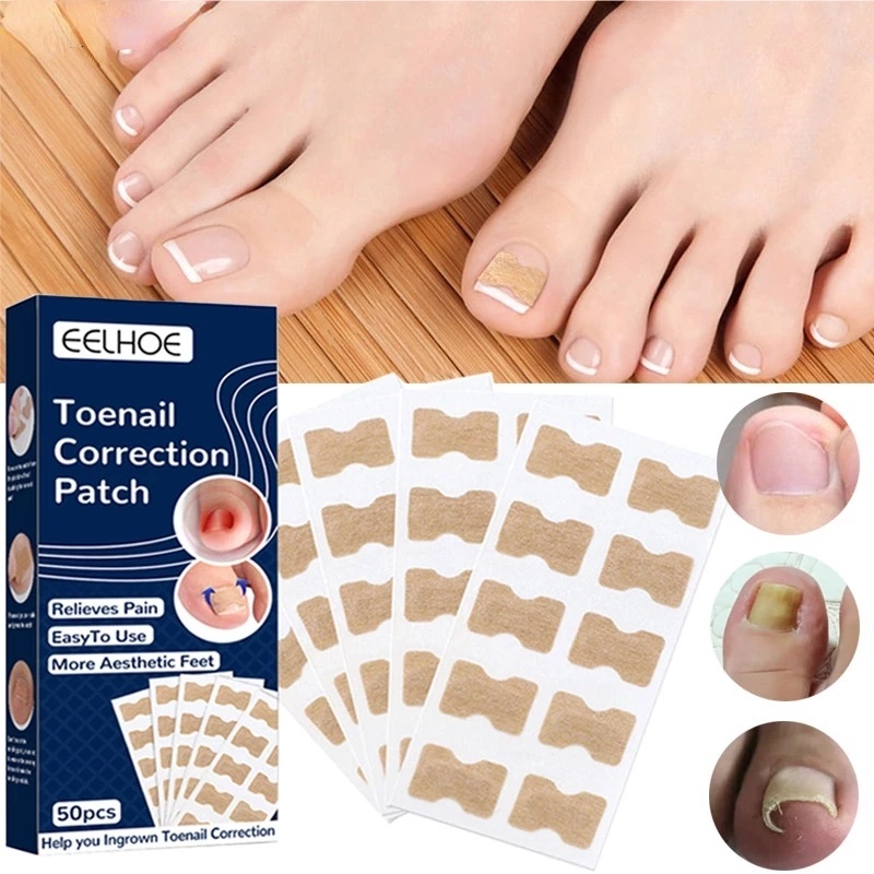 Miếng Dán Chỉnh Sửa Móng Chân Khỏe Mạnh Phù Hợp Cho Điều Chỉnh Móng Chân Bị Đau Chân