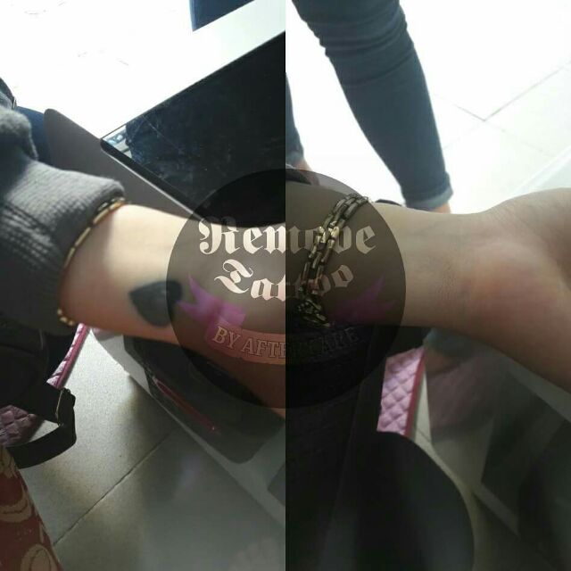Kem che xăm After care bộ kit 3 món giá hot | BigBuy360 - bigbuy360.vn