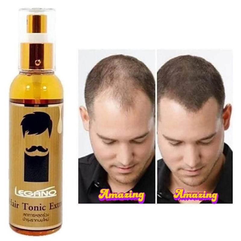 XỊT MỌC TÓC LEGANO HAIR TONIC EXTRA 120ML CHÍNH HÃNG - 9031