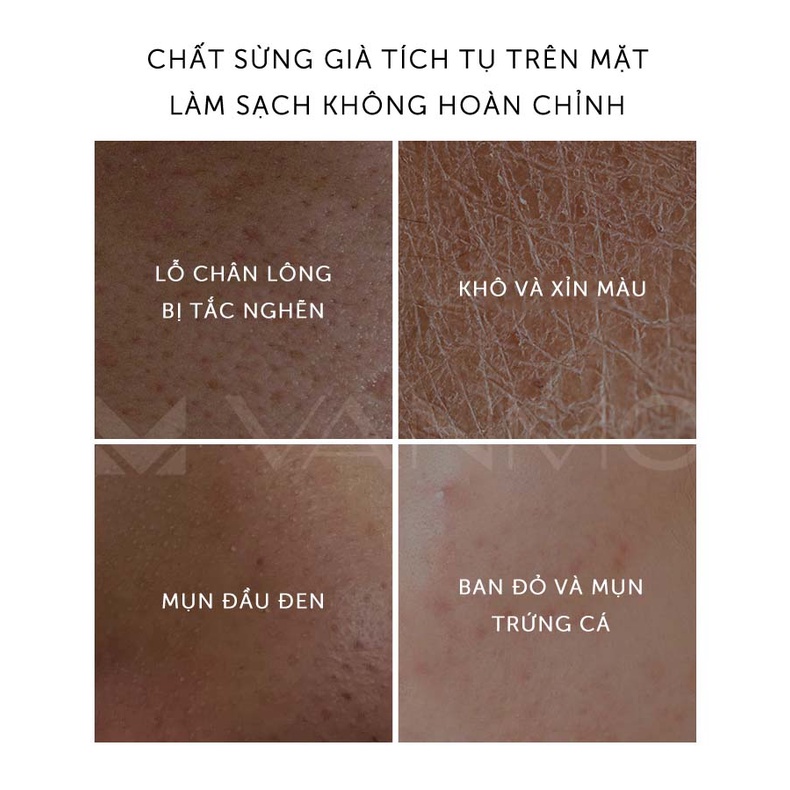 Gel Tẩy Tế Bào Chết Cho Da Mặt Cleansing Exfoliating Gel 80g