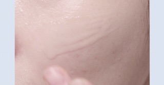Serum dưỡng trắng da
