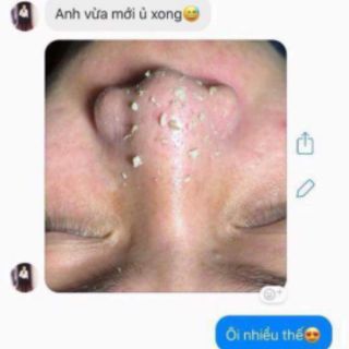 Ủ MỤN OHIO THẦN THÁNH