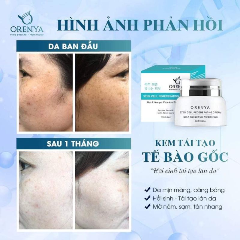 Kem Tái Tạo Tế Bào Gốc – Stem Cell Regenerating - ORENYA