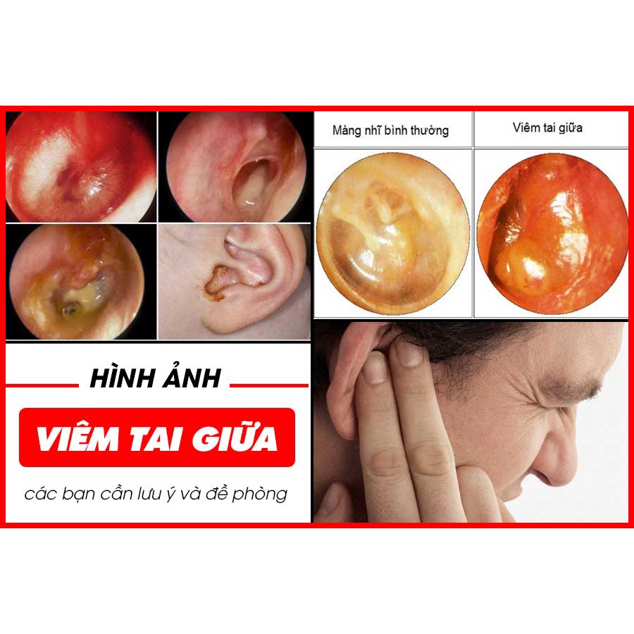 [CHÍNH HÃNG] Dung dịch nhỏ tai Thuần M.ộc