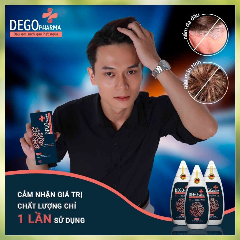 [CỰC HOT] Dầu gội đầu gàu,Nấm da đầu ,Diệt nấm gây gàu chấm dứt cảm giác ngứa Chiết xuất thiên nhiên từ vỏ cây Zizyphus | BigBuy360 - bigbuy360.vn