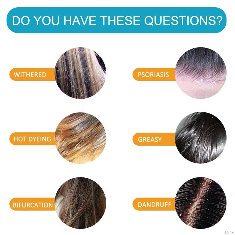 [Hàng mới về] Dầu gội muối biển hỗ trợ giảm gàu dưỡng ẩm cho da đầu