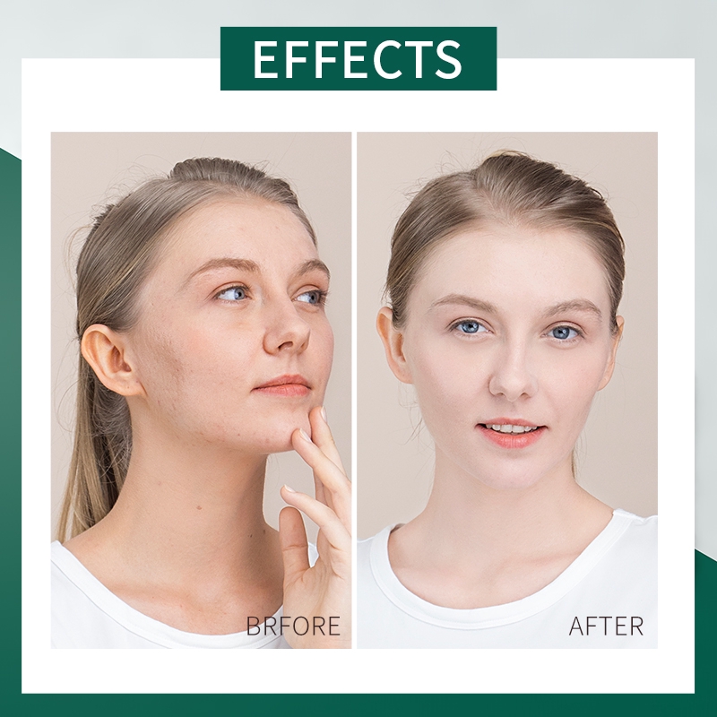 Bộ 3 mặt nạ ngủ LAIKOU Centella 3ml