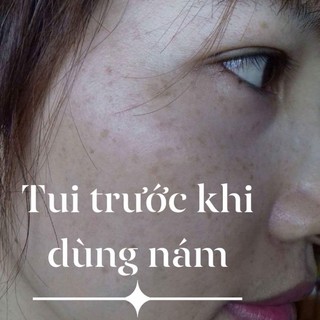 Kem Nám Lavoine