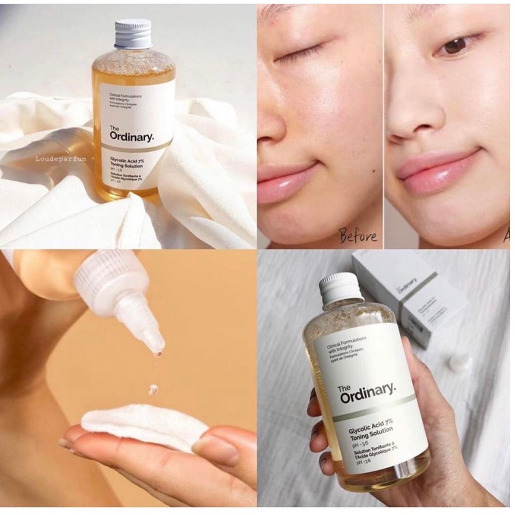 Nước Hoa Hồng The Ordinary Glycolic Acid 7% Toning Solution