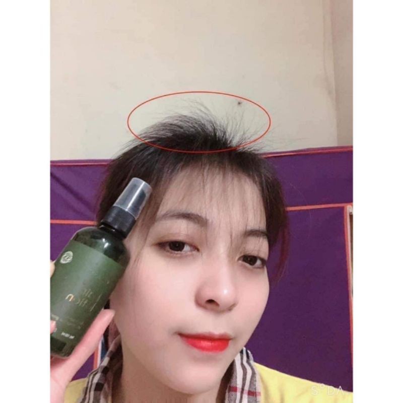 [ CHÍNH HÃNG ] Tinh dầu bưởi VIJULLY giúp mọc tóc nhanh, giảm rụng tóc, dùng được cho nam và nữ sản phẩm 100% thiên nhiê | BigBuy360 - bigbuy360.vn